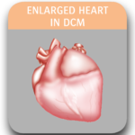 Image of enlarged heart