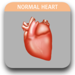 Image of normal heart